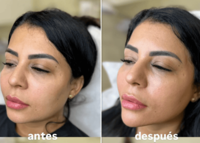 Fullface2