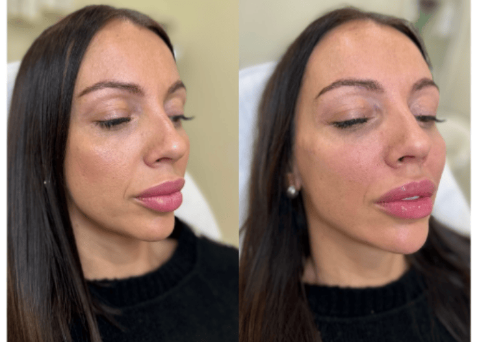Fullface3
