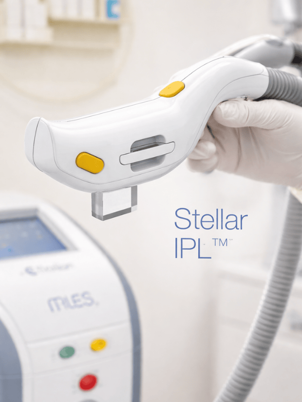 Stellar IPL