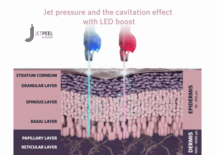 Jetpeel1
