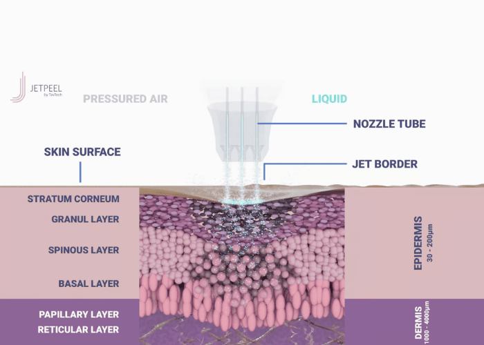 Jetpeel3